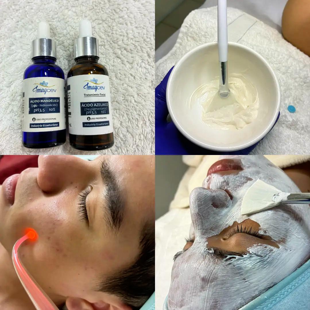 Facial Facial para Adolescentes